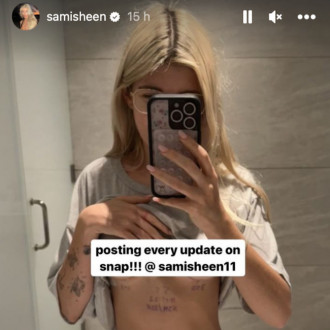 Charlie Sheen’s daughter Sami admits she’s in agony after going under knife for boob job: ‘Back pain is horrible!’