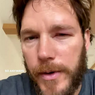 Chris Pratt stung on eyeball by a bee