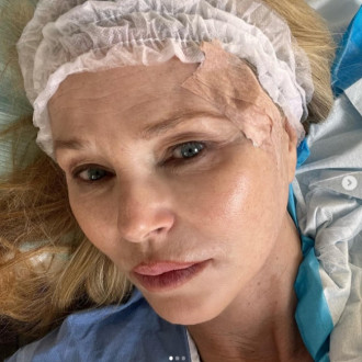 Christie Brinkley's cancer scar is 'barely noticeable'
