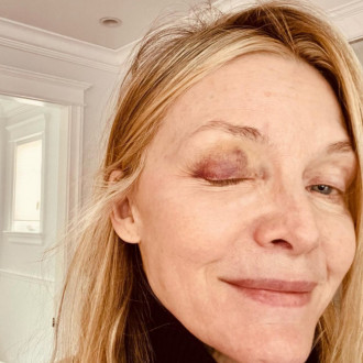 Michelle Pfeiffer details painful pickleball accident