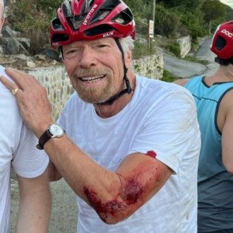 Sir Richard Branson bloodied and bruised after cycling crash