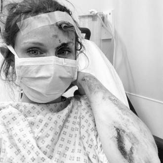 Sophie Ellis-Bextor rushed to hospital after bike accident 