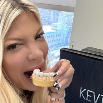 Tori Spelling got veneers after letting teeth turn to ‘s***’ in her 40s